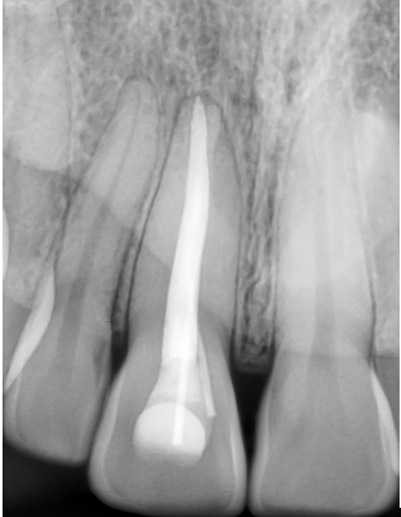 endodontics3.jpg